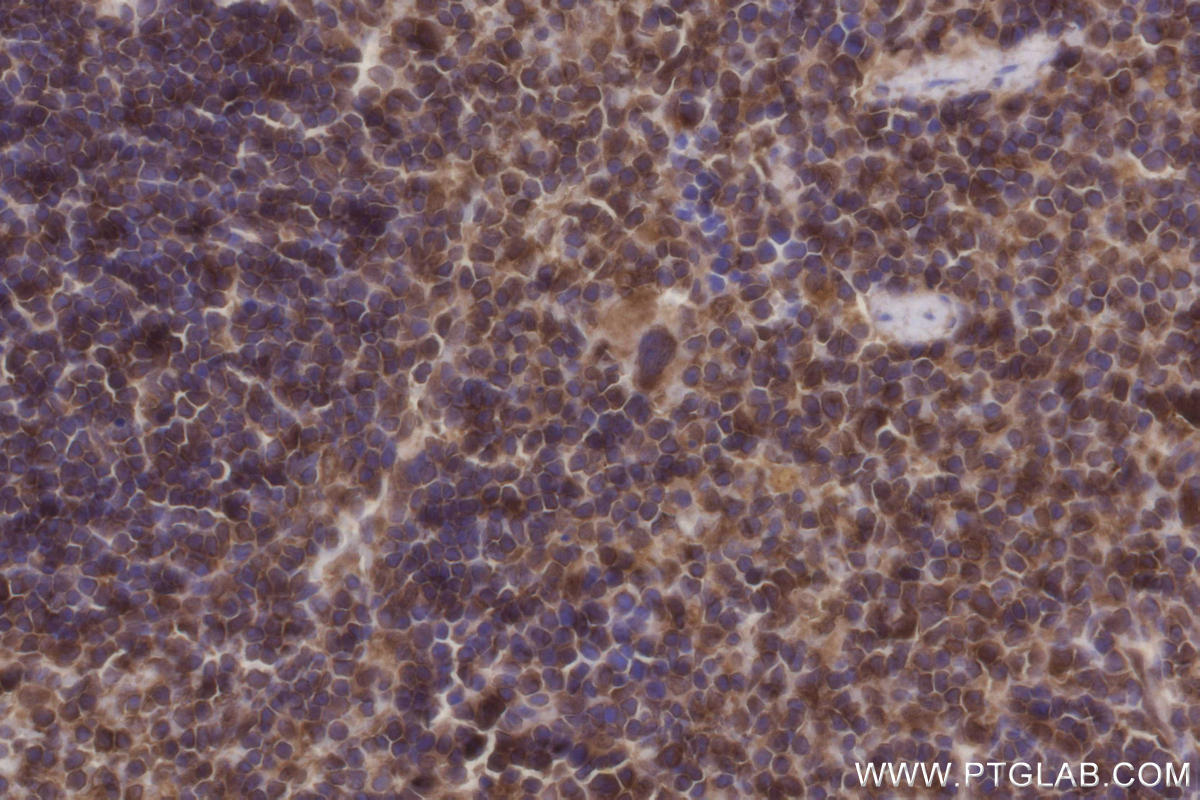 Immunohistochemical analysis of paraffin-embedded mouse spleen tissue slide using KHC2694 (DOCK8 IHC Kit).