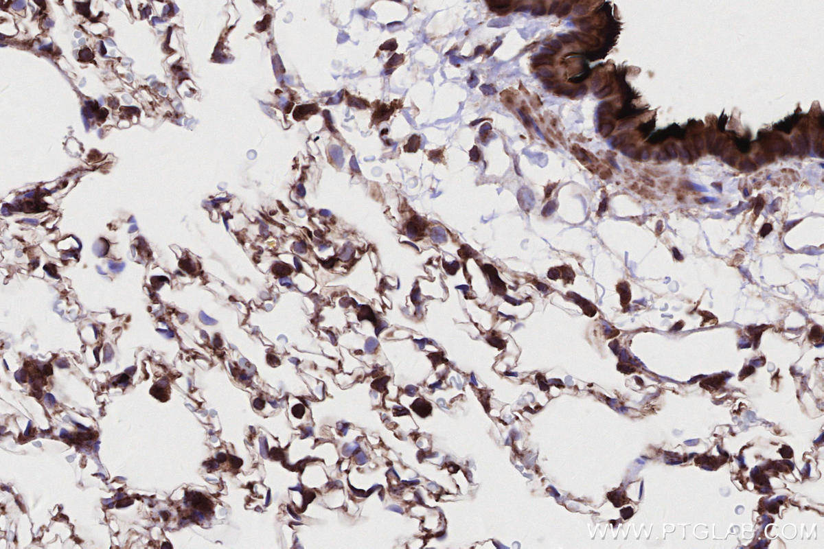 Immunohistochemical analysis of paraffin-embedded rat lung tissue slide using KHC2694 (DOCK8 IHC Kit).