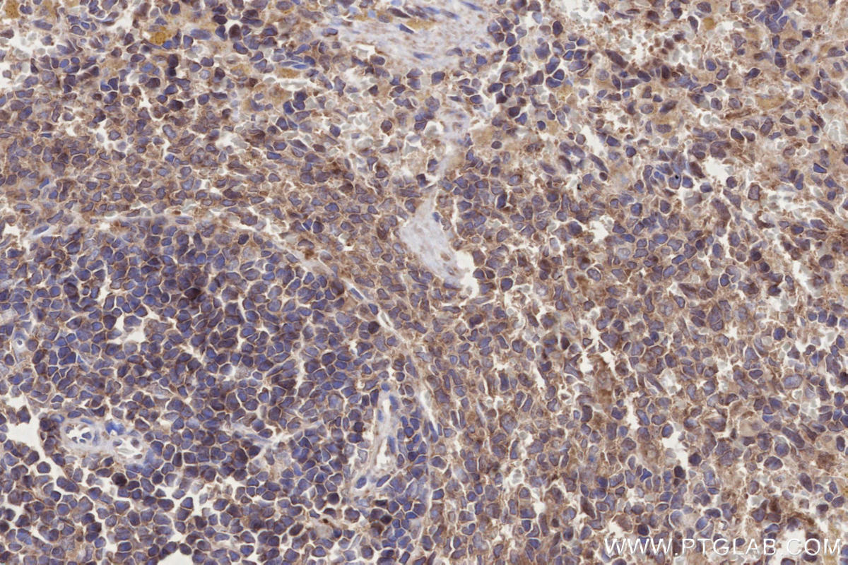 Immunohistochemical analysis of paraffin-embedded rat spleen tissue slide using KHC2694 (DOCK8 IHC Kit).