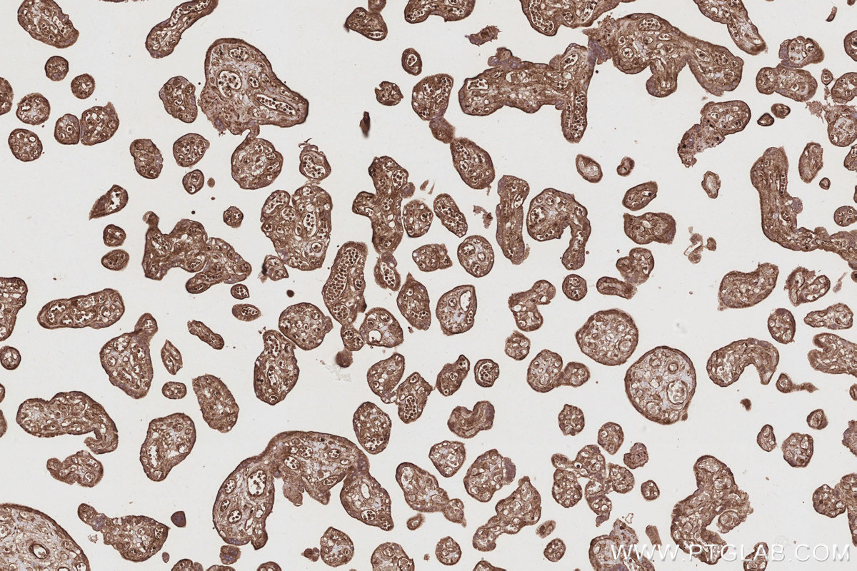 Immunohistochemical analysis of paraffin-embedded human placenta tissue slide using KHC2889 (DOCK9 IHC Kit).