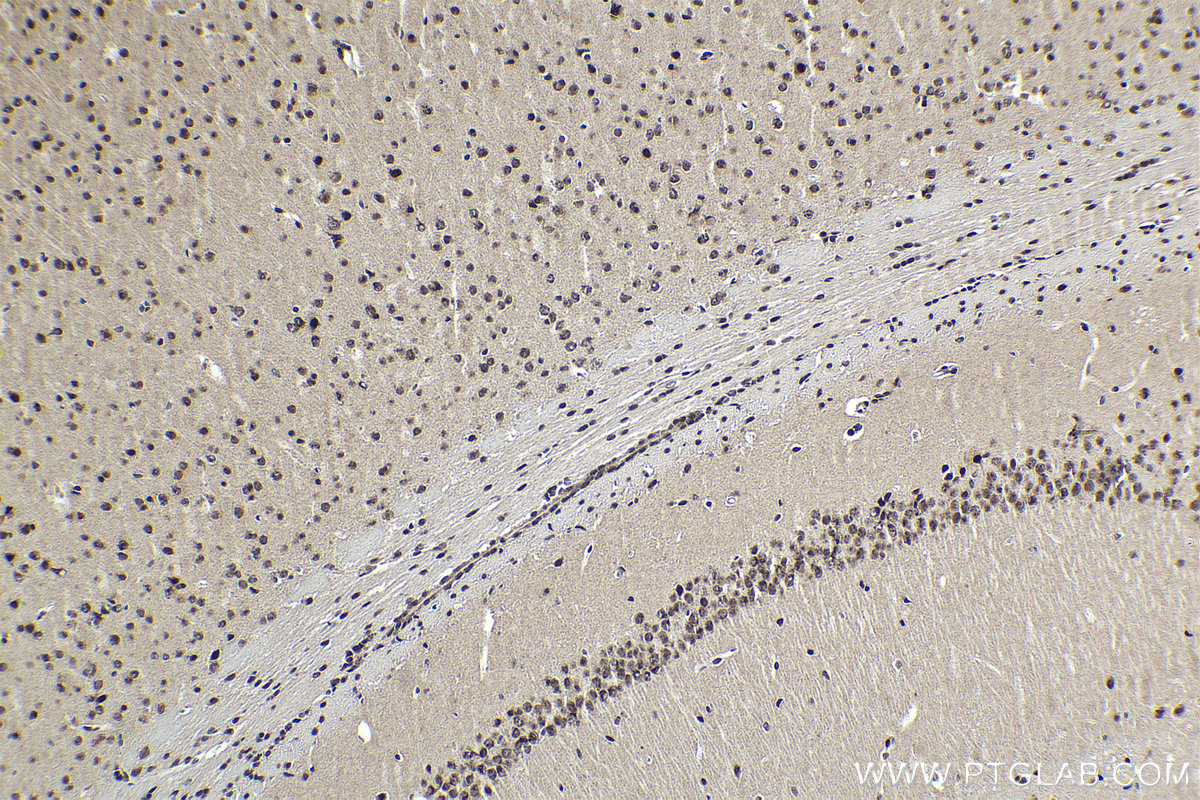 Immunohistochemical analysis of paraffin-embedded mouse brain tissue slide using KHC1855 (DPF2 IHC Kit).