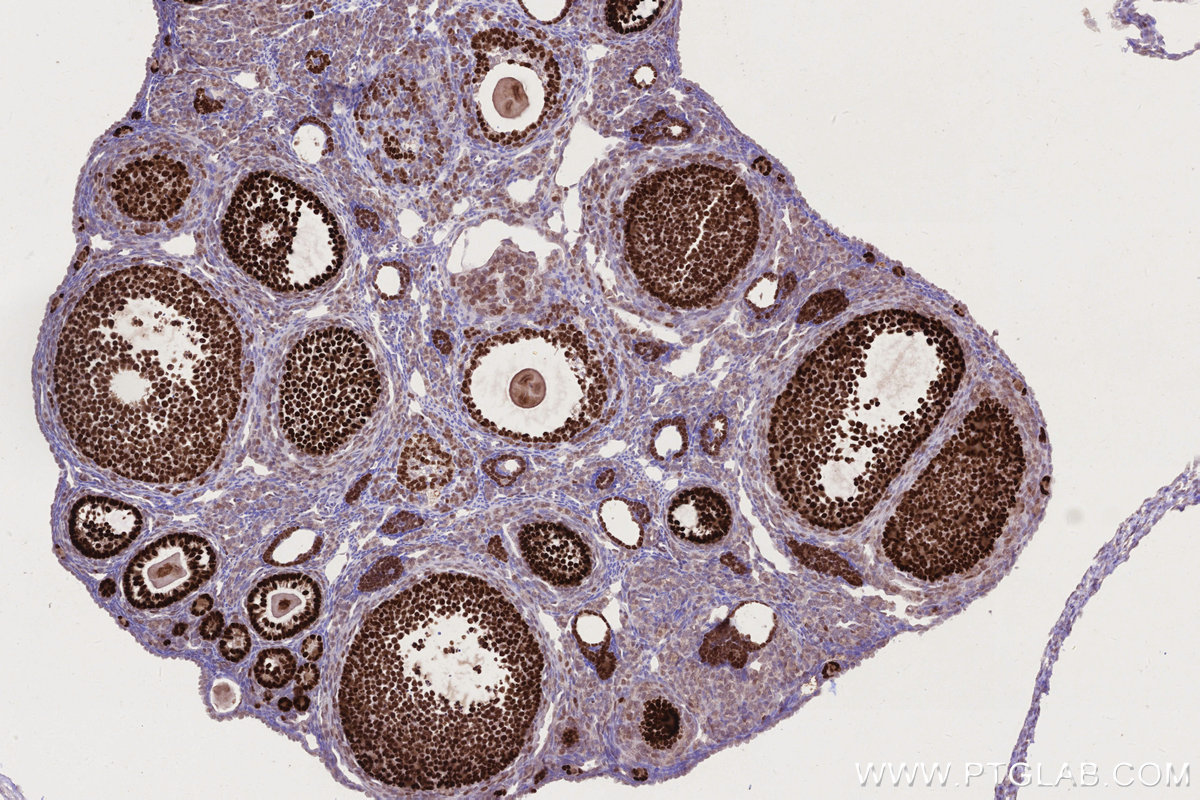 Immunohistochemical analysis of paraffin-embedded mouse ovary tissue slide using KHC2755 (DPF3 IHC Kit).