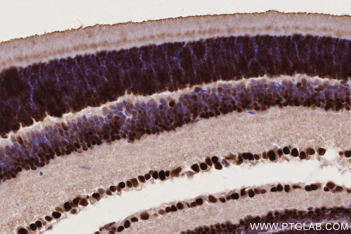 Immunohistochemical analysis of paraffin-embedded mouse eye tissue slide using KHC2755 (DPF3 IHC Kit).