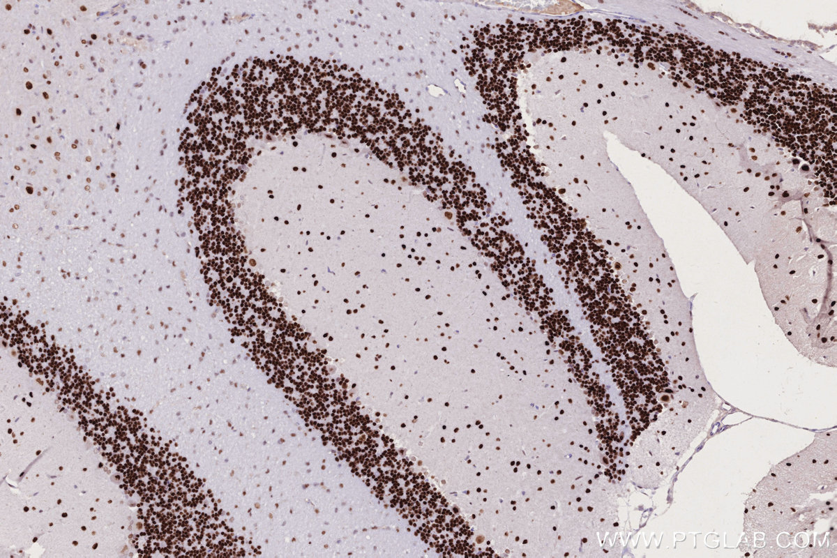 Immunohistochemical analysis of paraffin-embedded rat cerebellum tissue slide using KHC2755 (DPF3 IHC Kit).
