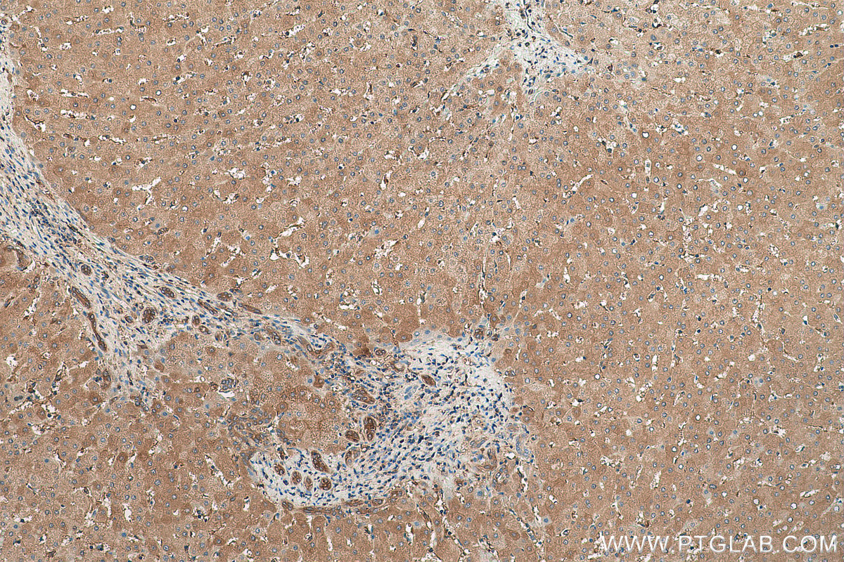 Immunohistochemical analysis of paraffin-embedded human liver tissue slide using KHC0824 (DPYD IHC Kit).