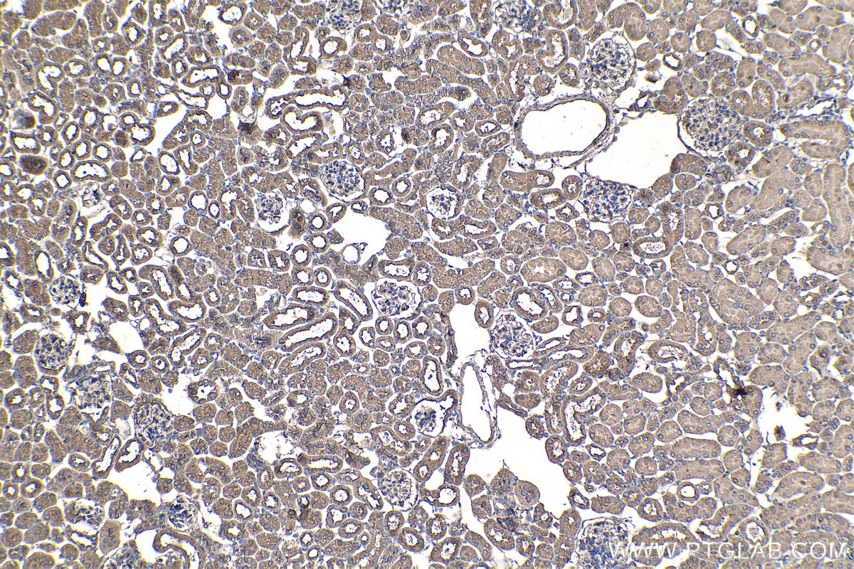 Immunohistochemical analysis of paraffin-embedded mouse kidney tissue slide using KHC1340 (DSE IHC Kit).