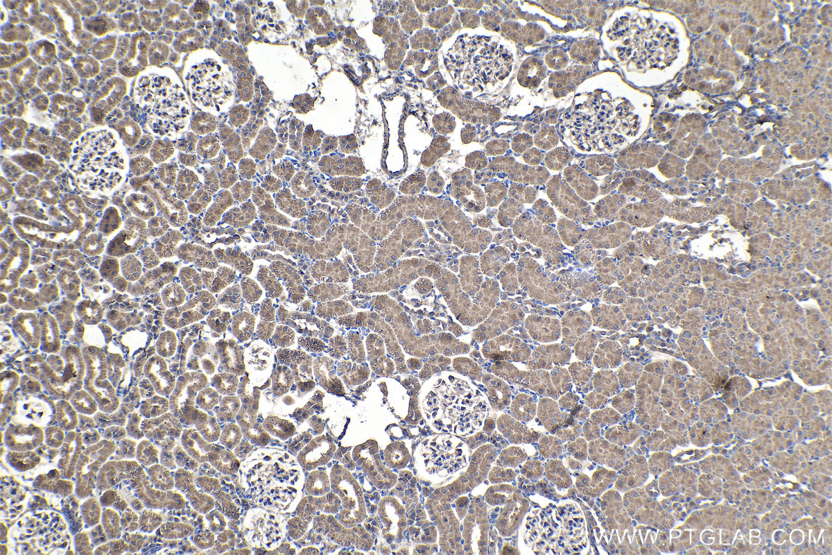 Immunohistochemical analysis of paraffin-embedded rat kidney tissue slide using KHC1340 (DSE IHC Kit).