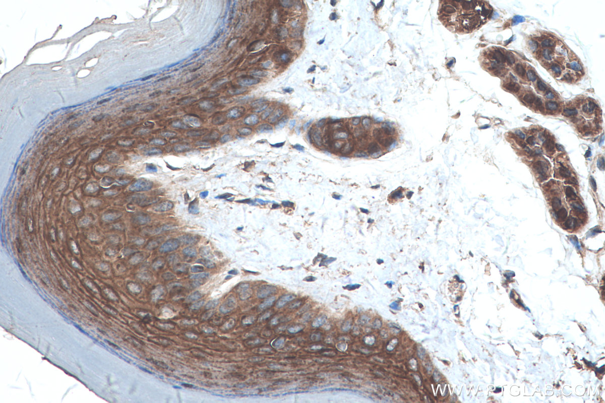 Immunohistochemical analysis of paraffin-embedded mouse skin tissue slide using KHC0259 (DSG1 IHC Kit).