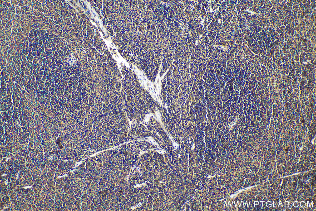 Immunohistochemical analysis of paraffin-embedded mouse spleen tissue slide using KHC1637 (DSS1 IHC Kit).