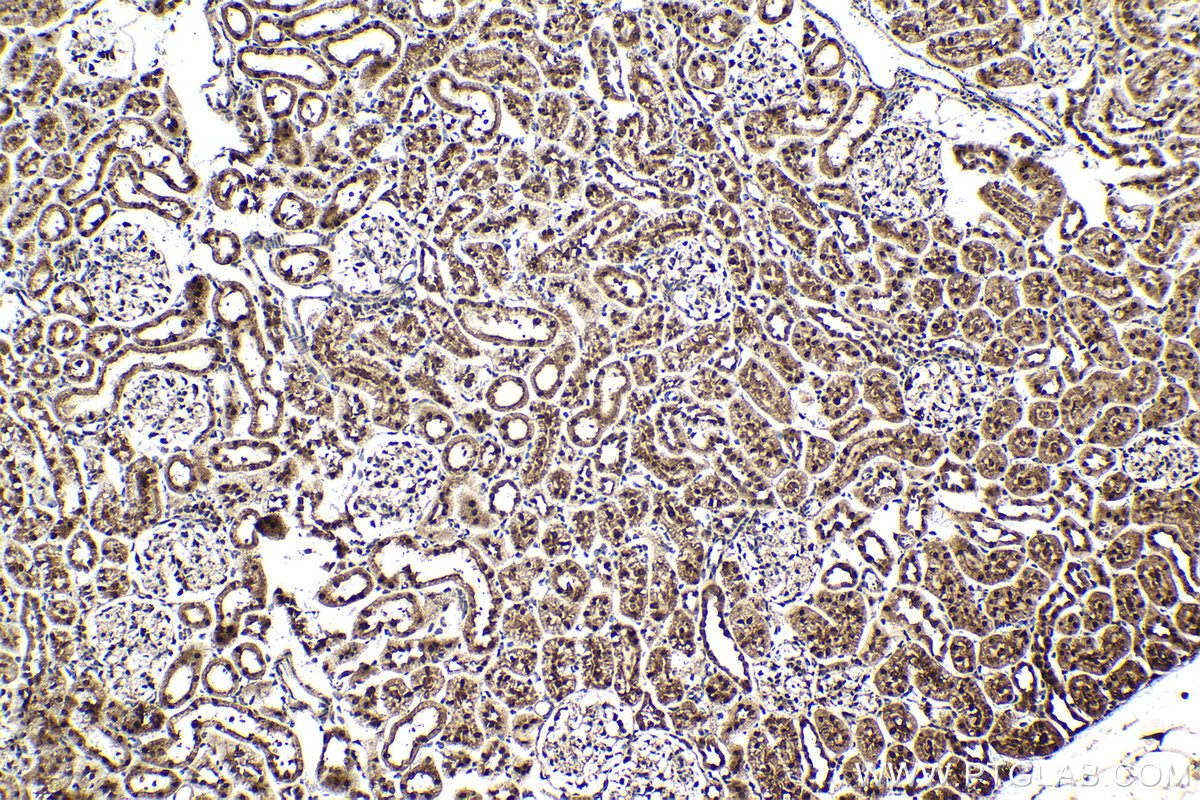 Immunohistochemical analysis of paraffin-embedded rat kidney tissue slide using KHC1637 (DSS1 IHC Kit).