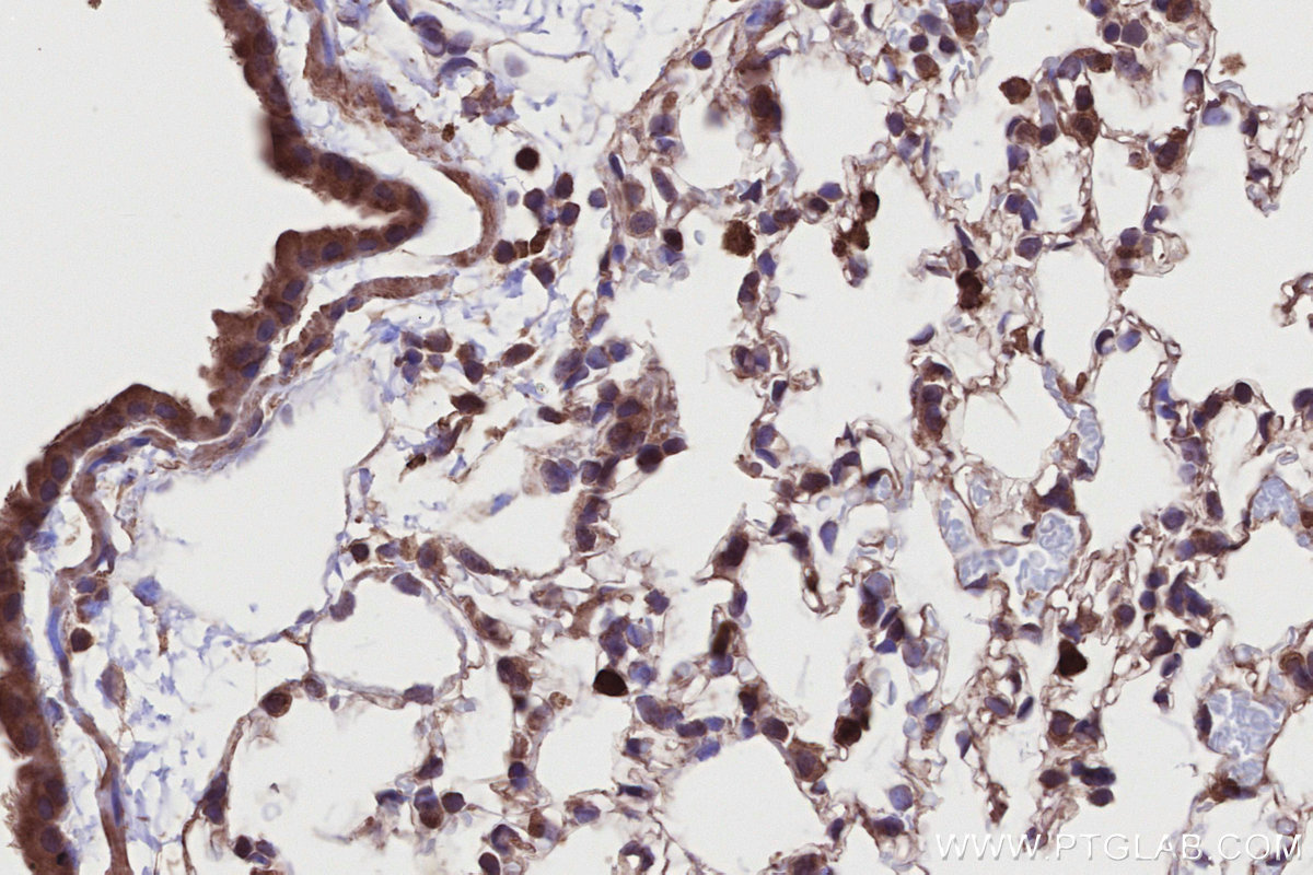 Immunohistochemical analysis of paraffin-embedded mouse lung tissue slide using KHC2717 (DTX3L IHC Kit).