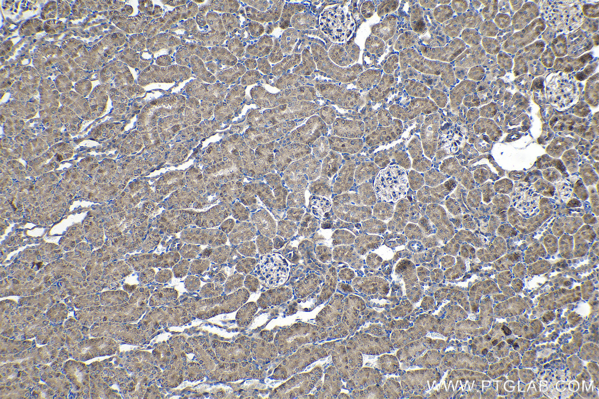 Immunohistochemical analysis of paraffin-embedded rat kidney tissue slide using KHC1403 (DTYMK IHC Kit).