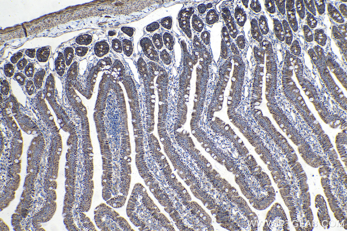 Immunohistochemical analysis of paraffin-embedded rat small intestine tissue slide using KHC1403 (DTYMK IHC Kit).