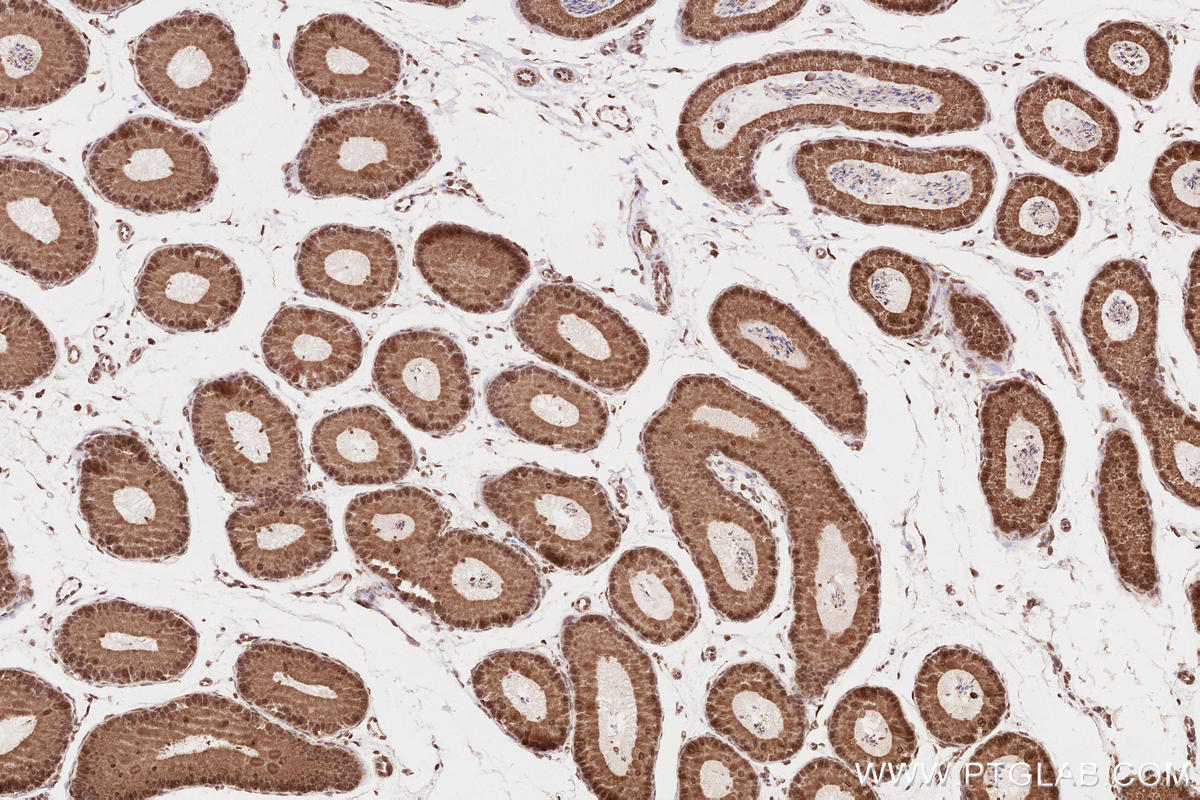 Immunohistochemical analysis of paraffin-embedded mouse epididymis tissue slide using KHC2595 (DUB3 IHC Kit).