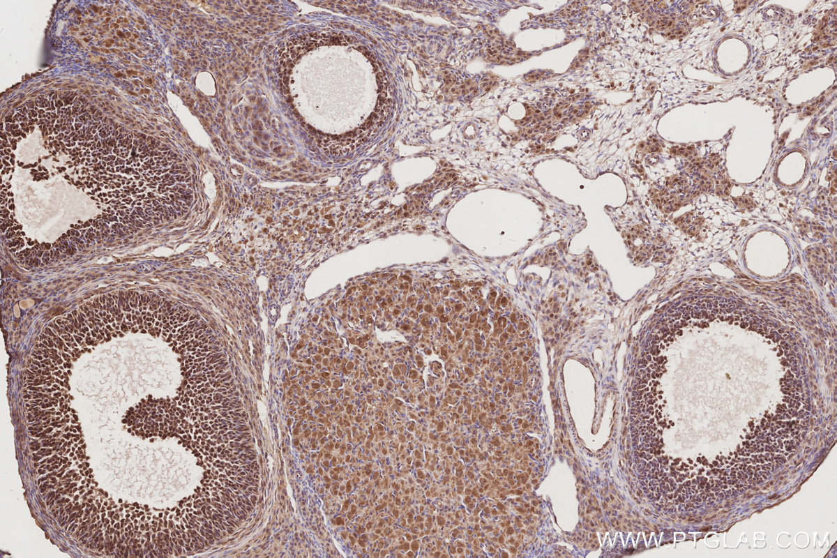 Immunohistochemical analysis of paraffin-embedded rat ovary tissue slide using KHC2885 (DUSP16 IHC Kit).
