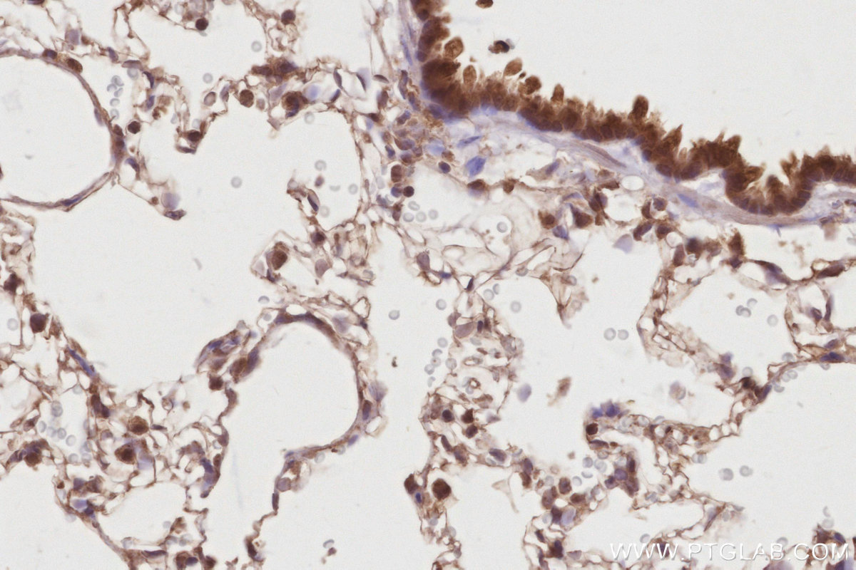 Immunohistochemical analysis of paraffin-embedded rat lung tissue slide using KHC2885 (DUSP16 IHC Kit).