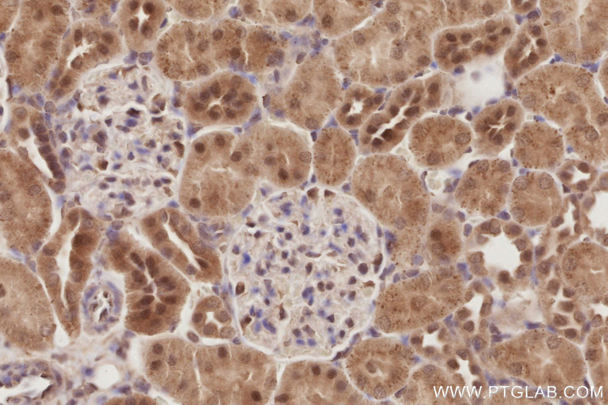Immunohistochemical analysis of paraffin-embedded rat kidney tissue slide using KHC2885 (DUSP16 IHC Kit).