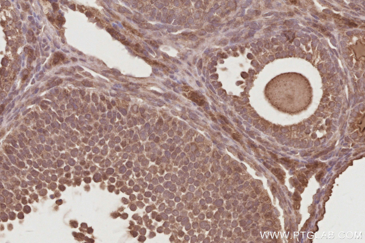 Immunohistochemical analysis of paraffin-embedded mouse ovary tissue slide using KHC2885 (DUSP16 IHC Kit).