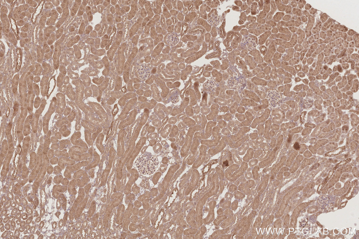 Immunohistochemical analysis of paraffin-embedded mouse kidney tissue slide using KHC2885 (DUSP16 IHC Kit).