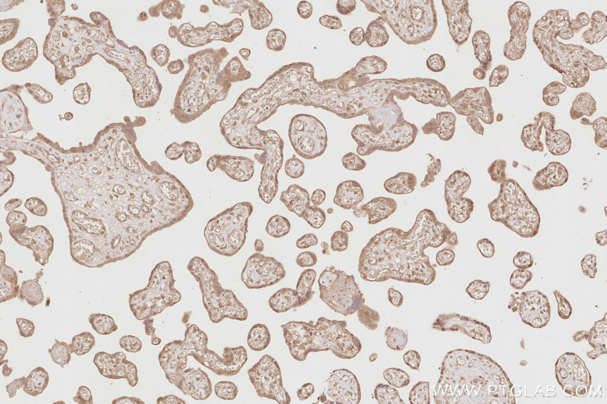 Immunohistochemical analysis of paraffin-embedded human placenta tissue slide using KHC2885 (DUSP16 IHC Kit).