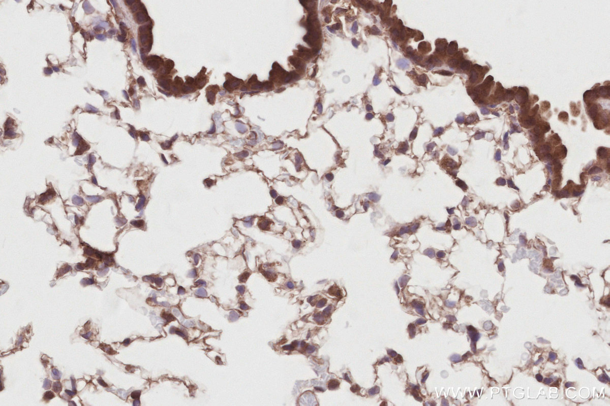 Immunohistochemical analysis of paraffin-embedded mouse lung tissue slide using KHC2885 (DUSP16 IHC Kit).