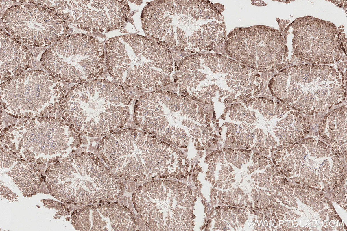 Immunohistochemical analysis of paraffin-embedded mouse testis tissue slide using KHC2850 (DUSP9 IHC Kit).