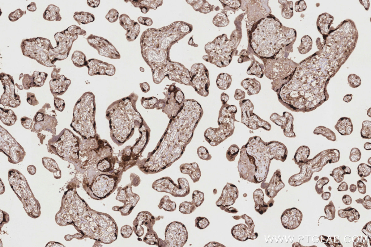 Immunohistochemical analysis of paraffin-embedded human placenta tissue slide using KHC2850 (DUSP9 IHC Kit).