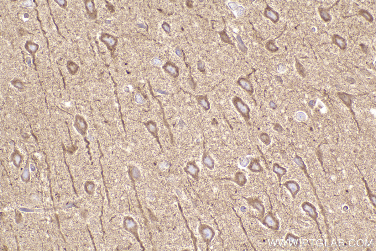 Immunohistochemical analysis of paraffin-embedded rat brain tissue slide using KHC2455 (DYNC1H1 IHC Kit).