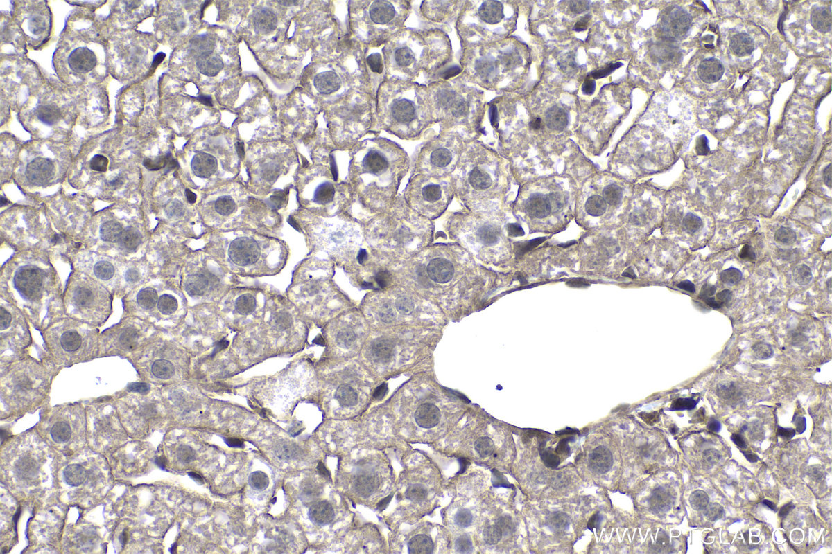 Immunohistochemical analysis of paraffin-embedded mouse liver tissue slide using KHC0975 (DYNLL1 IHC Kit).