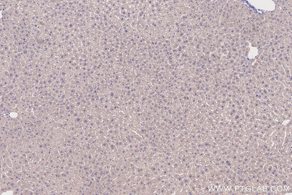Immunohistochemical analysis of paraffin-embedded mouse liver tissue slide using KHC2750 (DYRK2 IHC Kit).