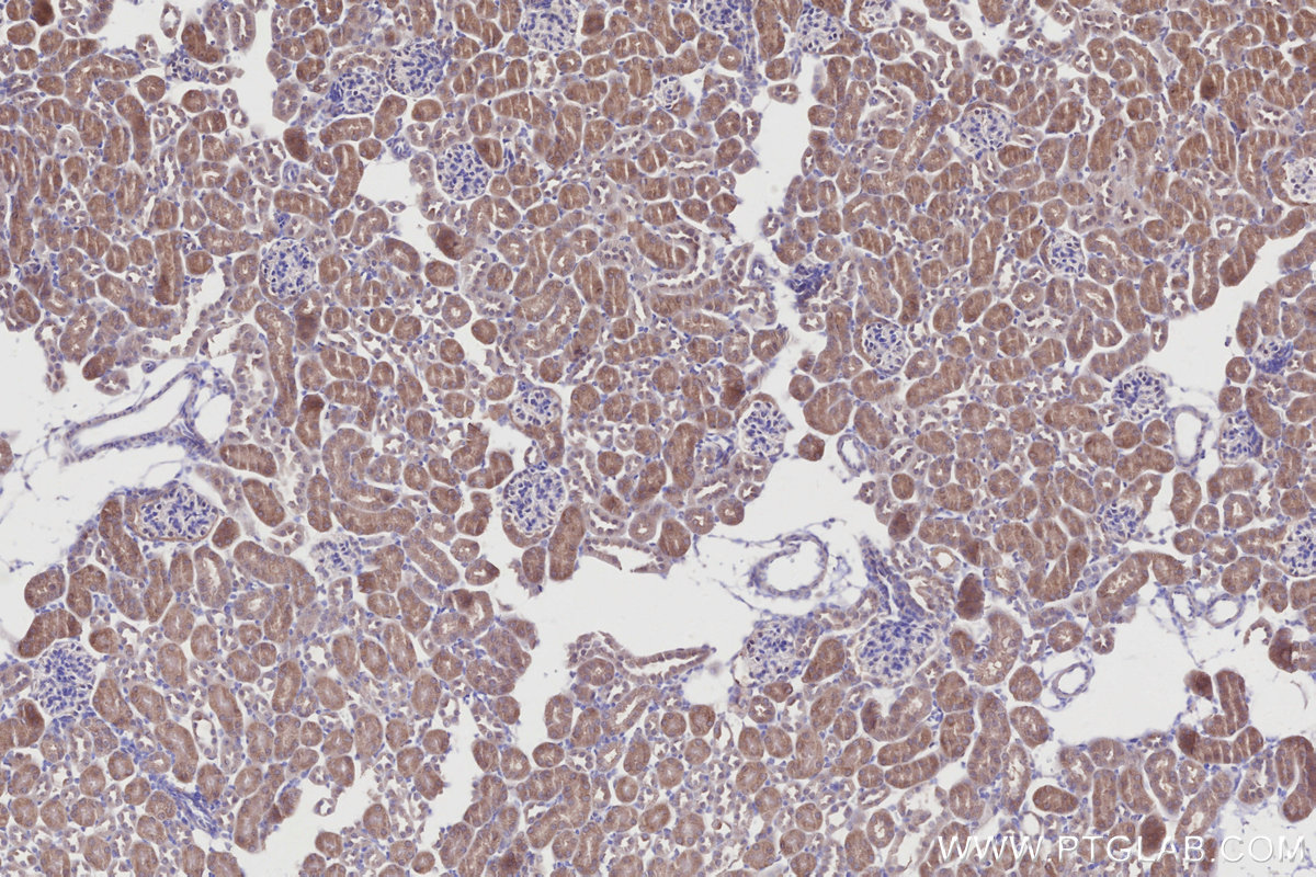 Immunohistochemical analysis of paraffin-embedded mouse kidney tissue slide using KHC2750 (DYRK2 IHC Kit).
