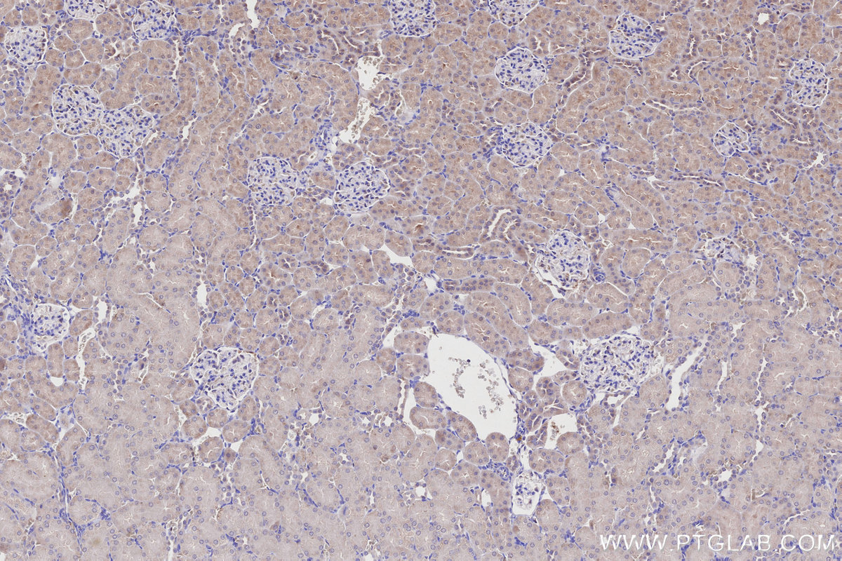 Immunohistochemical analysis of paraffin-embedded rat kidney tissue slide using KHC2750 (DYRK2 IHC Kit).