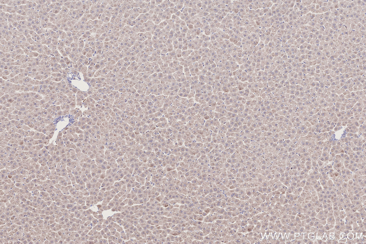 Immunohistochemical analysis of paraffin-embedded rat liver tissue slide using KHC2750 (DYRK2 IHC Kit).