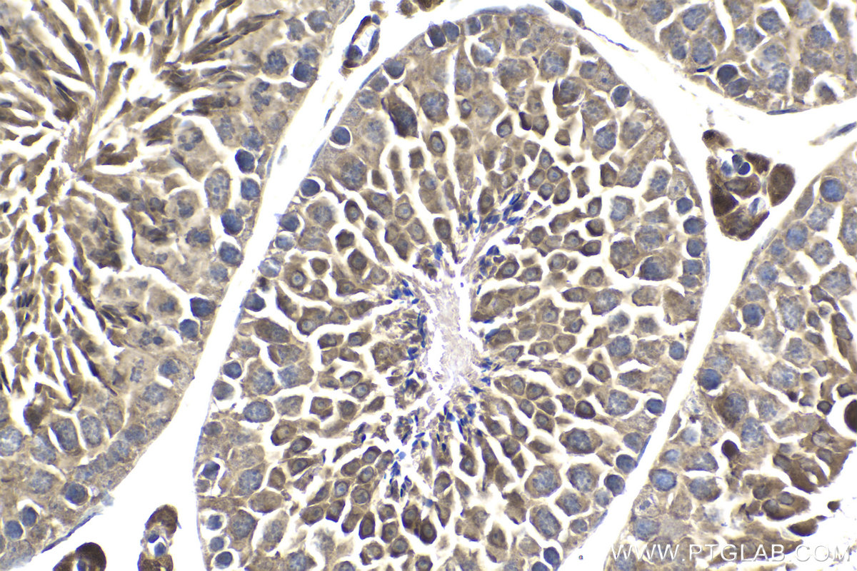 Immunohistochemical analysis of paraffin-embedded mouse testis tissue slide using KHC1812 (DZIP1 IHC Kit).