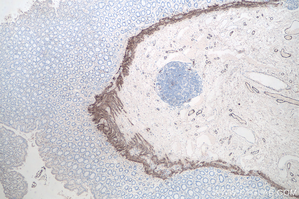 Immunohistochemical analysis of paraffin-embedded human colon tissue slide using KHC0100 (Desmin IHC Kit).