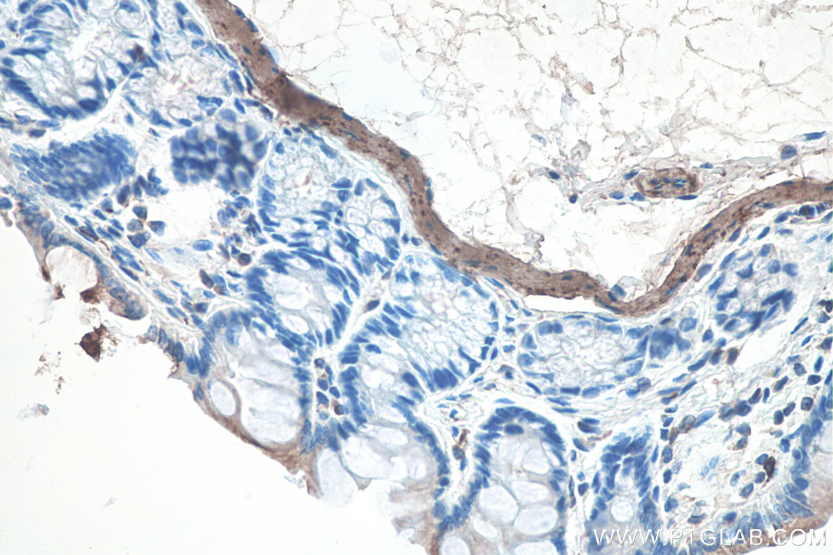 Immunohistochemical analysis of paraffin-embedded rat colon tissue slide using KHC0100 (Desmin IHC Kit).