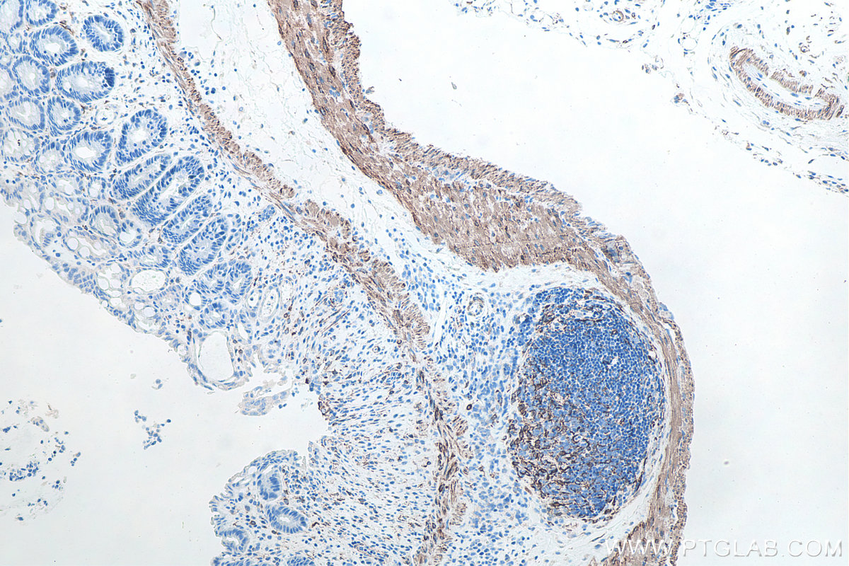 Immunohistochemical analysis of paraffin-embedded mouse colon tissue slide using KHC0100 (Desmin IHC Kit).