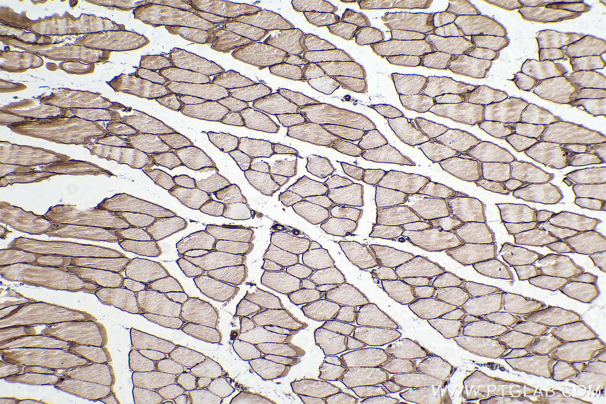 Immunohistochemical analysis of paraffin-embedded mouse skeletal muscle tissue slide using KHC0284 (Dystrophin/DMD IHC Kit).