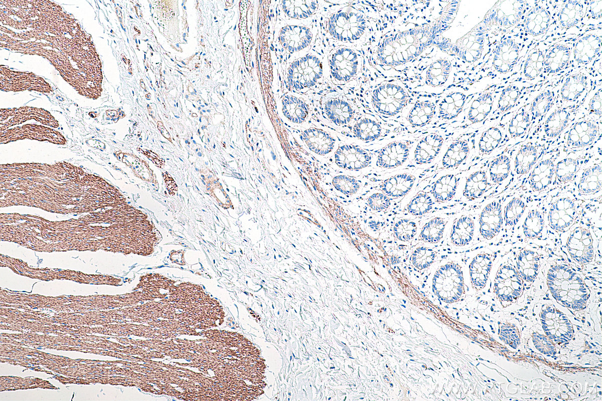 Immunohistochemical analysis of paraffin-embedded human colon tissue slide using KHC0284 (Dystrophin/DMD IHC Kit).