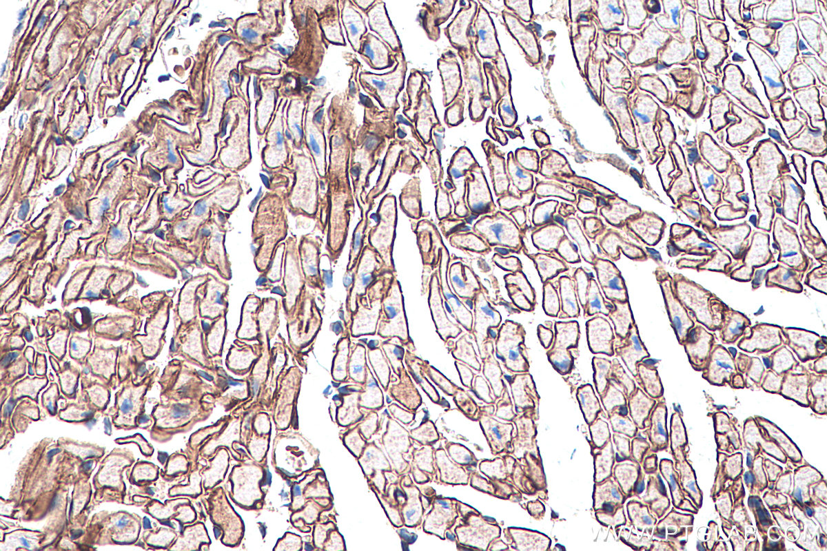 Immunohistochemical analysis of paraffin-embedded mouse heart tissue slide using KHC0284 (Dystrophin/DMD IHC Kit).
