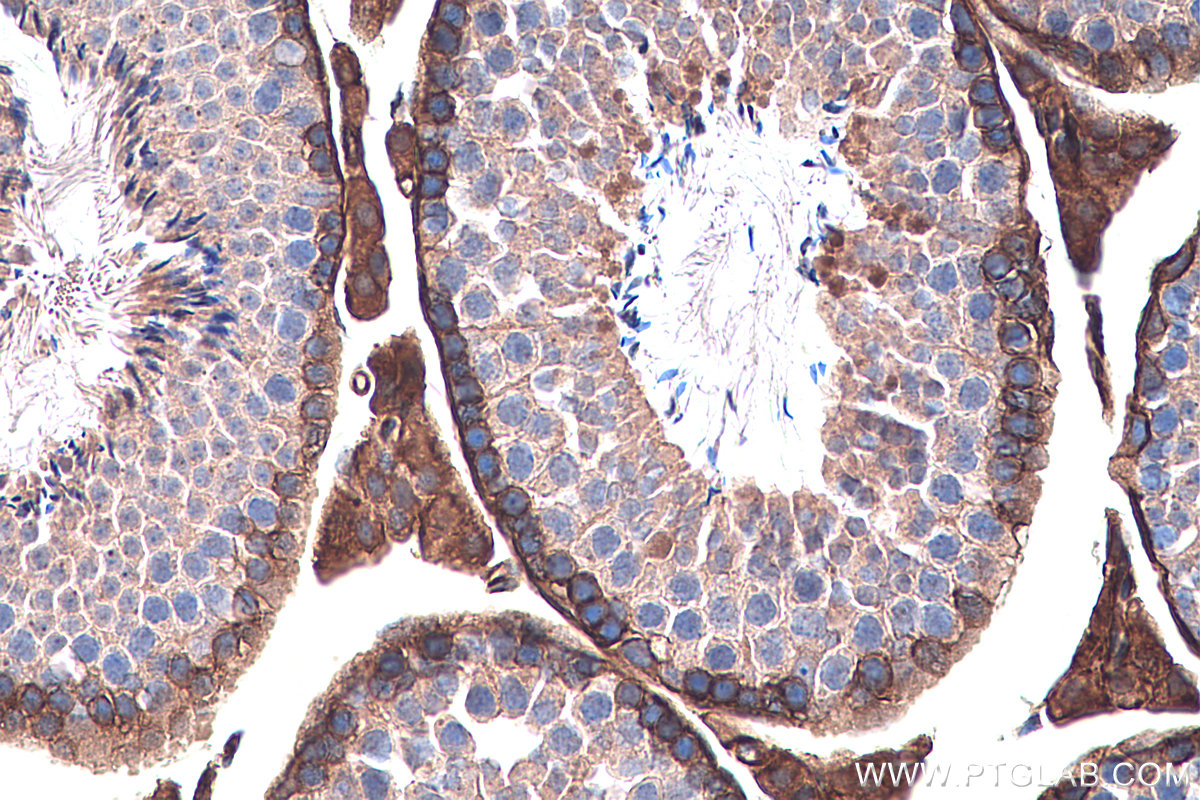 Immunohistochemical analysis of paraffin-embedded mouse testis tissue slide using KHC0284 (Dystrophin/DMD IHC Kit).