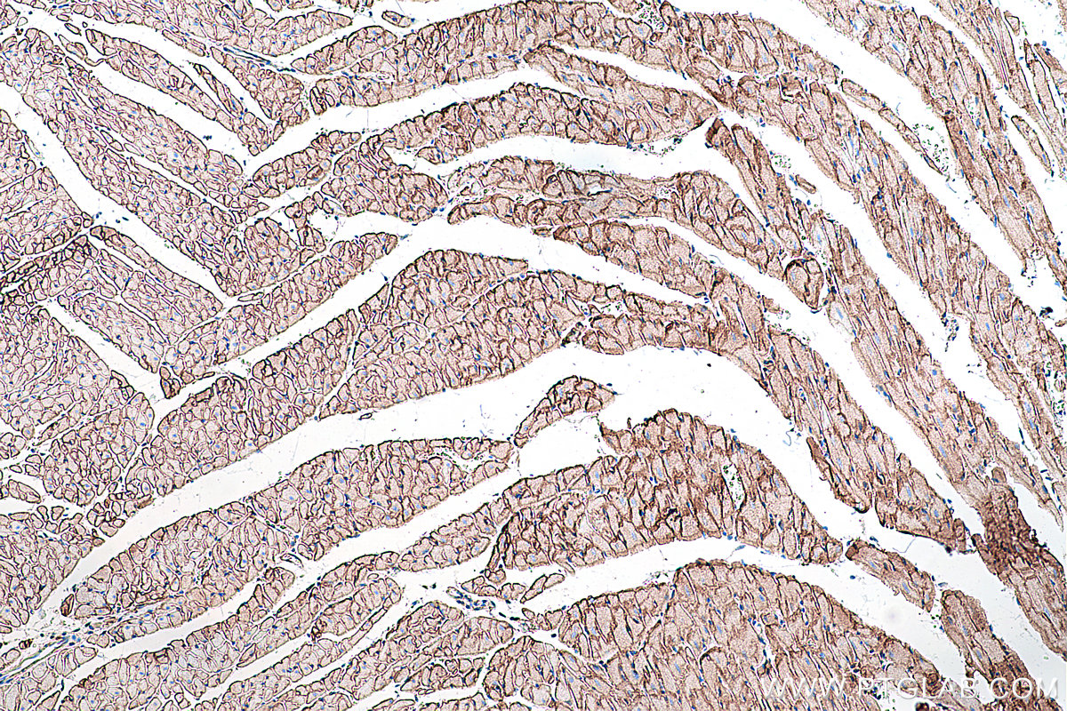 Immunohistochemical analysis of paraffin-embedded rat heart tissue slide using KHC0284 (Dystrophin/DMD IHC Kit).