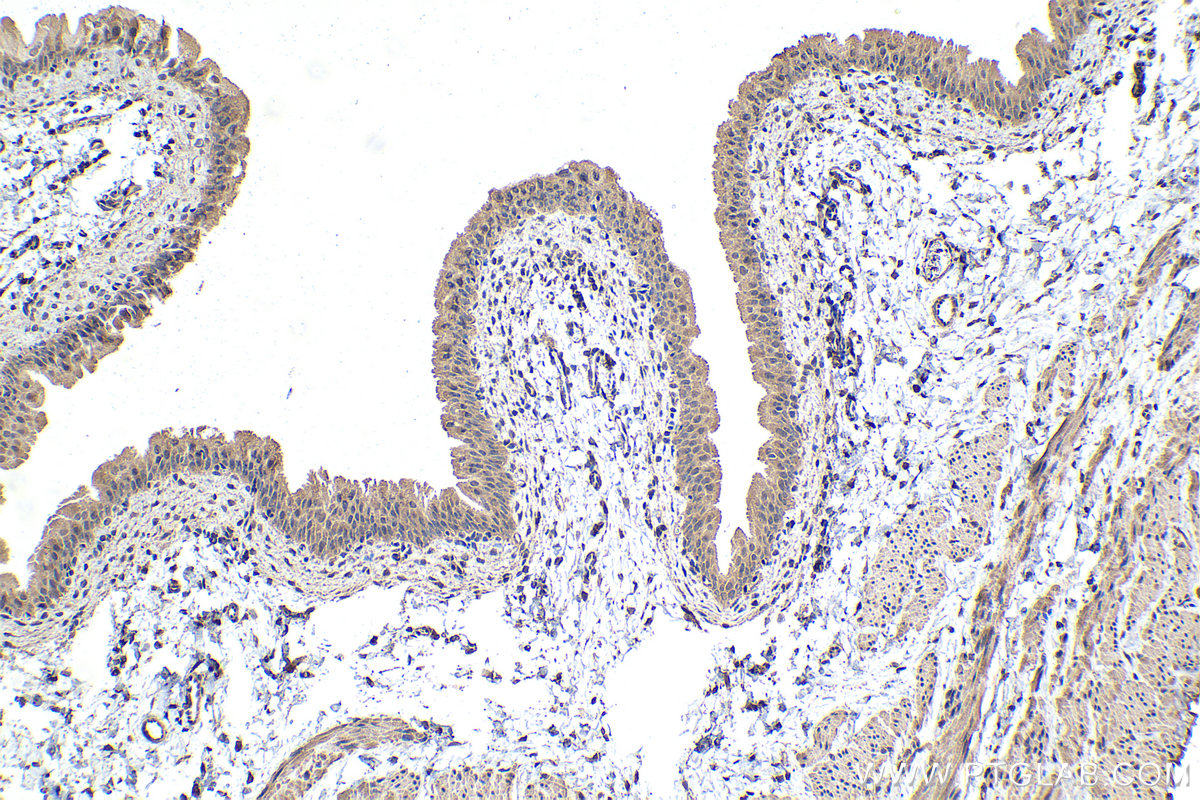 Immunohistochemical analysis of paraffin-embedded rat bladder tissue slide using KHC1501 (ECD IHC Kit).