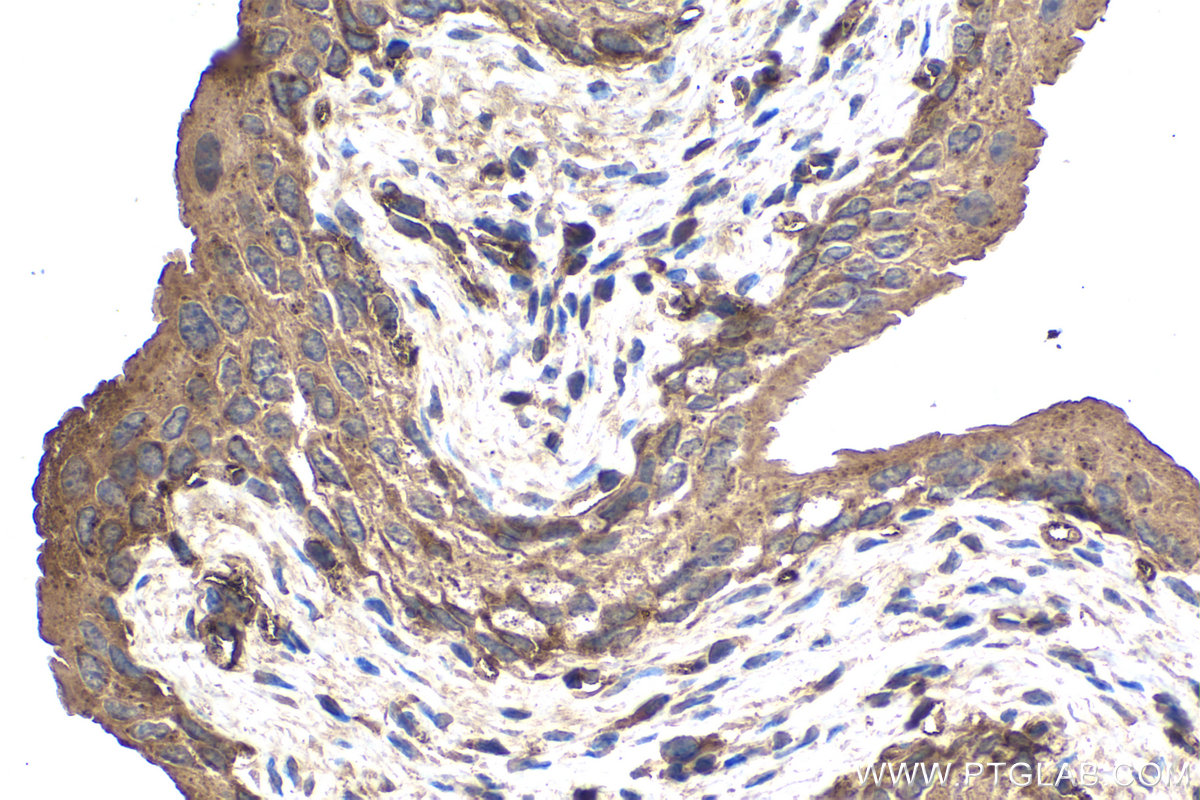 Immunohistochemical analysis of paraffin-embedded mouse bladder tissue slide using KHC1501 (ECD IHC Kit).