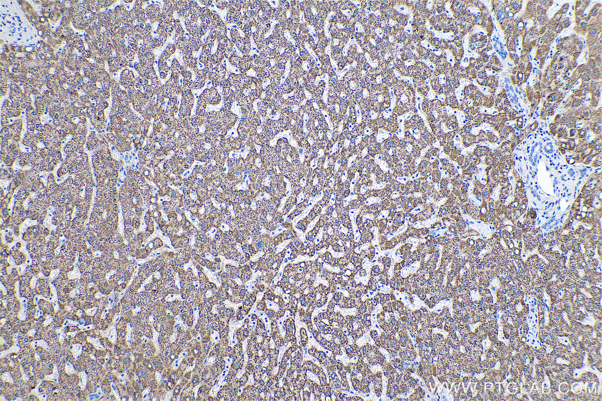 Immunohistochemical analysis of paraffin-embedded human liver tissue slide using KHC0514 (ECHS1 IHC Kit).