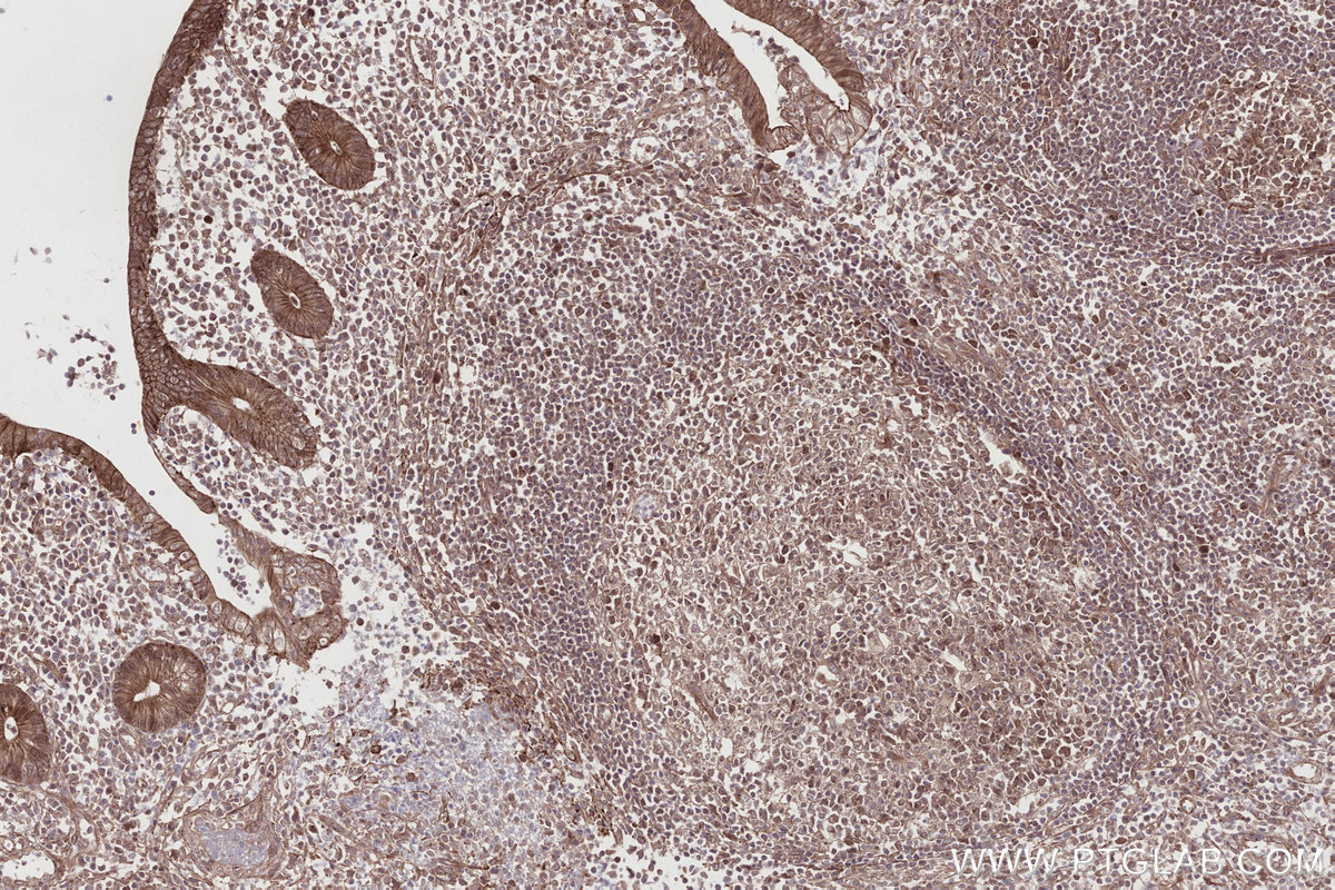 Immunohistochemical analysis of paraffin-embedded human appendicitis tissue slide using KHC2749 (EDEM1 IHC Kit).