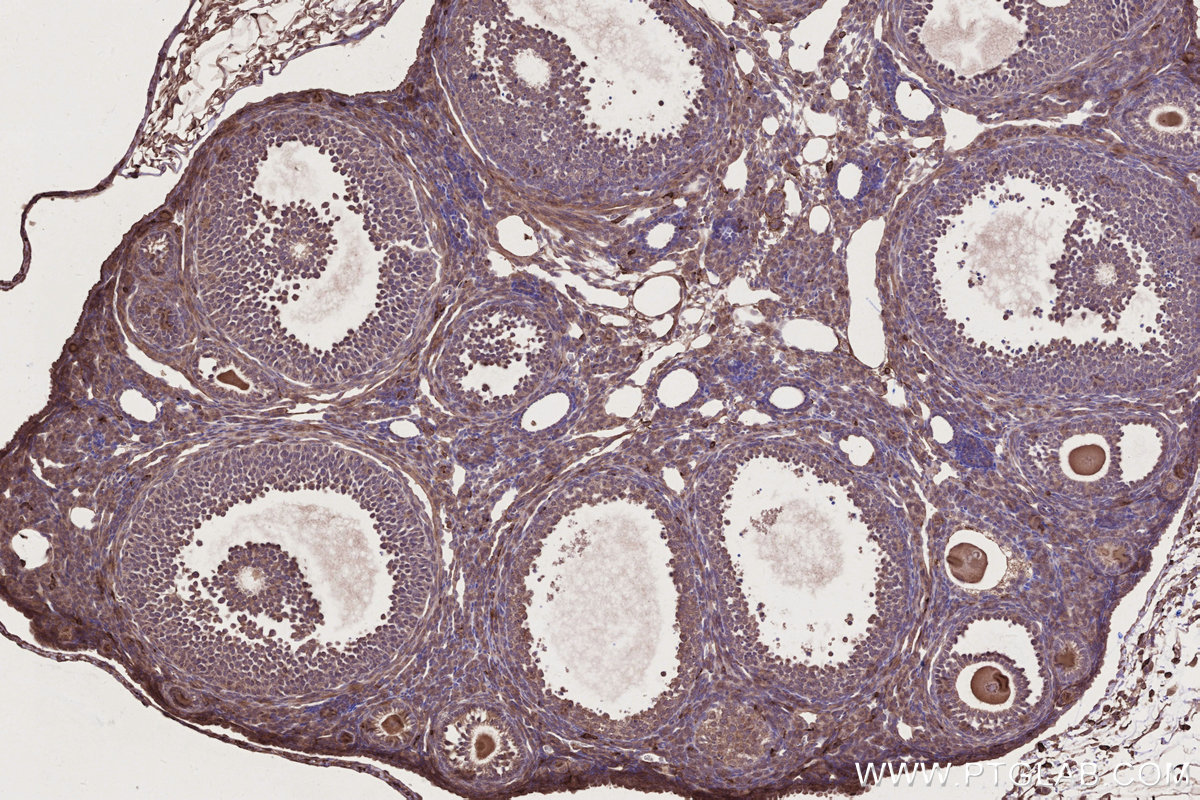 Immunohistochemical analysis of paraffin-embedded mouse ovary tissue slide using KHC2751 (EDG2/LPAR1 IHC Kit).