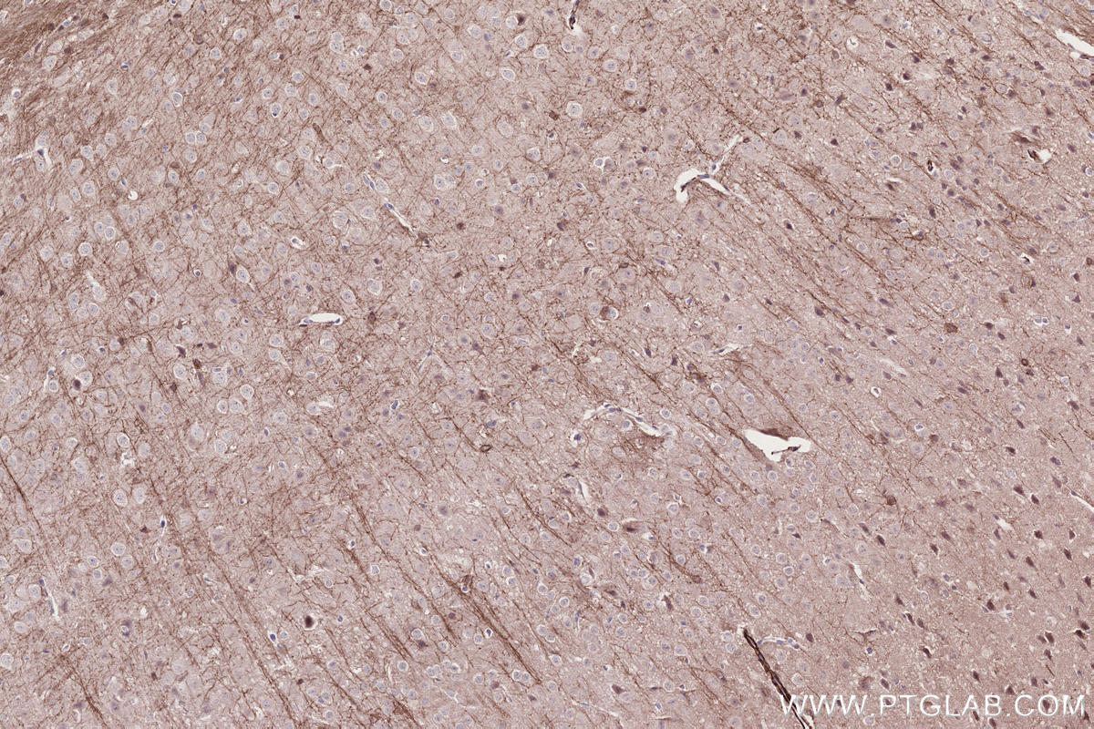 Immunohistochemical analysis of paraffin-embedded mouse brain tissue slide using KHC2751 (EDG2/LPAR1 IHC Kit).