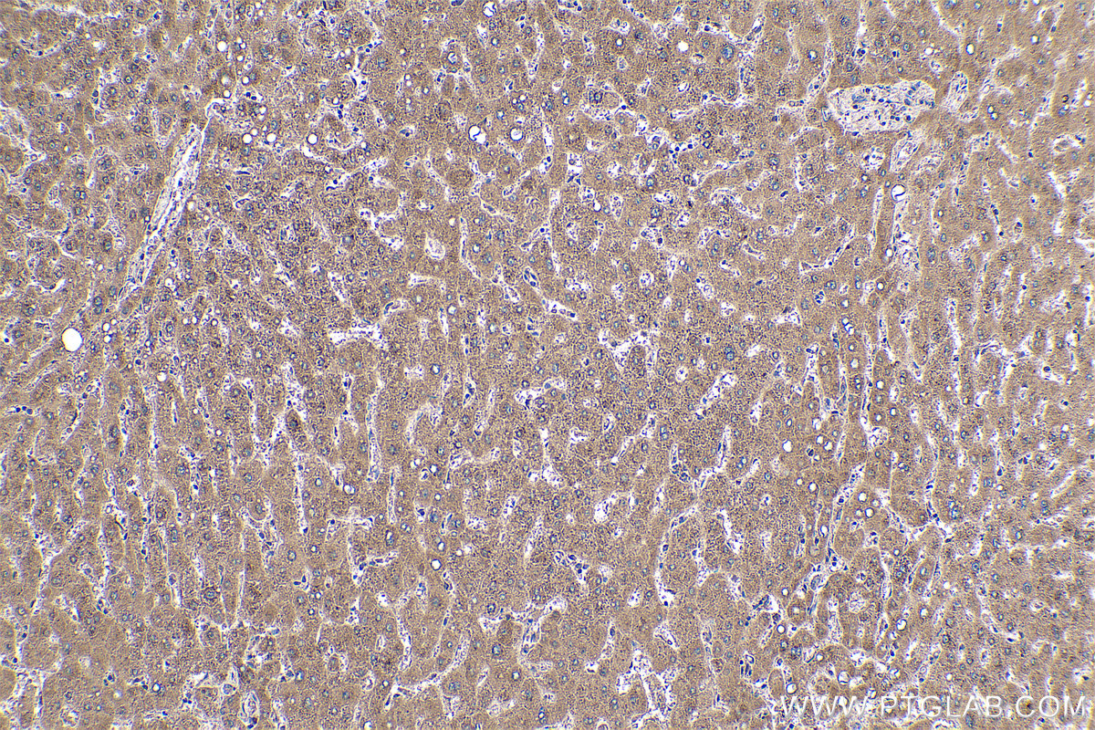 Immunohistochemical analysis of paraffin-embedded human liver tissue slide using KHC0508 (EEF1A1 IHC Kit).