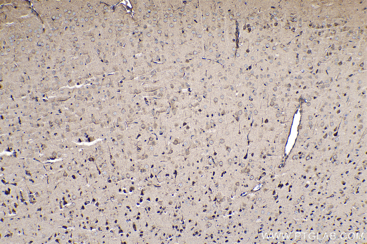 Immunohistochemical analysis of paraffin-embedded rat brain tissue slide using KHC0508 (EEF1A1 IHC Kit).